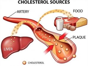 kiểm soát cholesterrol trong máu
